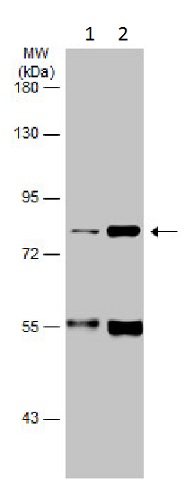 Western blot - Anti-FACL4 antibody (ab227256), expandable thumbnail