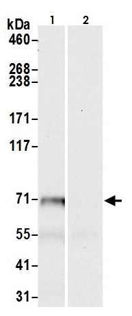 Immunoprecipitation - Anti-FACL4 antibody (AB264397), expandable thumbnail