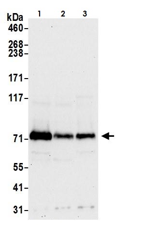 Western blot - Anti-FACL4 antibody (AB264397), expandable thumbnail