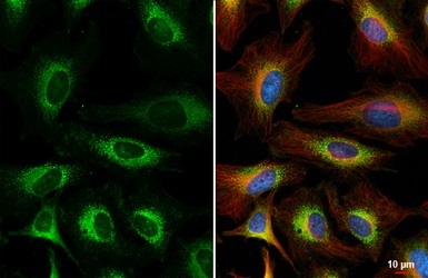 Immunocytochemistry/ Immunofluorescence - Anti-FACL4 antibody - Carboxyterminal end (AB137525)