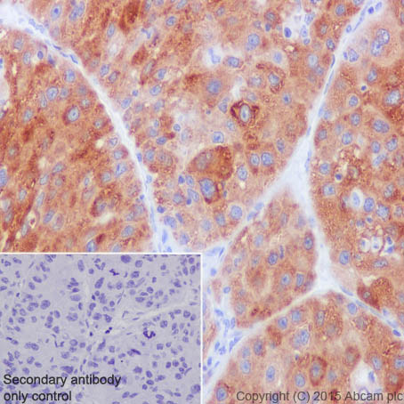 Immunohistochemistry (Formalin/PFA-fixed paraffin-embedded sections) - Anti-FACL4 antibody [EPR17587-42] (AB205199), expandable thumbnail