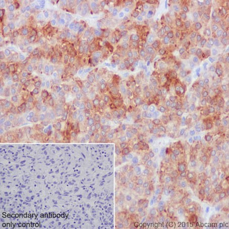 Immunohistochemistry (Formalin/PFA-fixed paraffin-embedded sections) - Anti-FACL4 antibody [EPR17587] (AB205197), expandable thumbnail