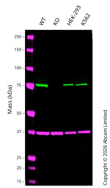 Western blot - Anti-FACL4 antibody [EPR17587] (AB205197)
