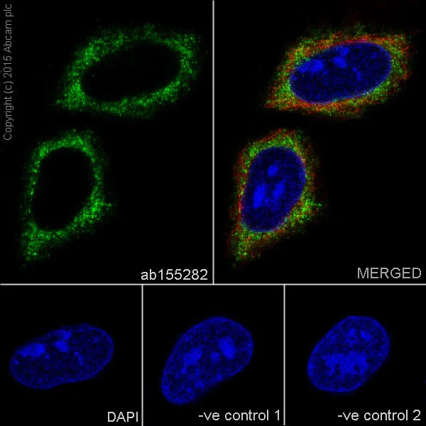 Immunocytochemistry/ Immunofluorescence - Anti-FACL4 antibody [EPR8640] (AB155282)