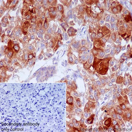 Immunohistochemistry (Formalin/PFA-fixed paraffin-embedded sections) - Anti-FACL4 antibody [EPR8640] (AB155282), expandable thumbnail