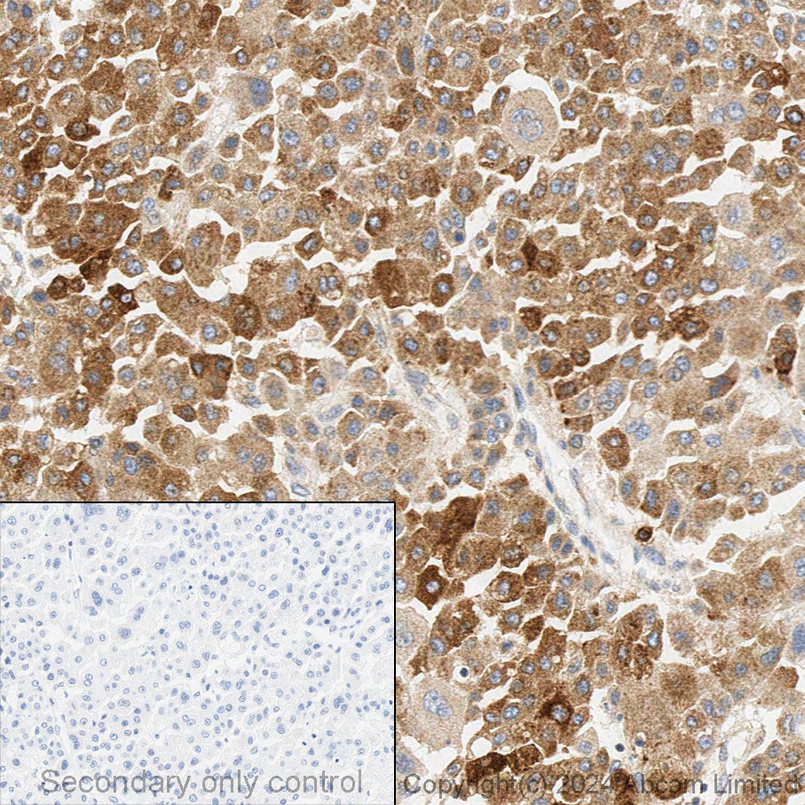 Immunohistochemistry (Formalin/PFA-fixed paraffin-embedded sections) - Anti-FACL4 antibody [EPR8640] (ab155282), expandable thumbnail