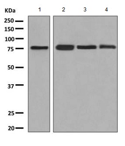 Western blot - Anti-FACL4 antibody [EPR8640] (ab155282), expandable thumbnail