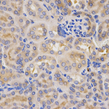 Immunohistochemistry (Formalin/PFA-fixed paraffin-embedded sections) - Anti-Factor B antibody (AB192577)