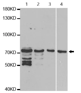 Western blot - Anti-Factor B antibody (AB192577)
