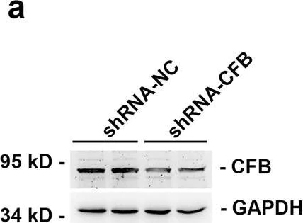 Western blot - Anti-Factor B antibody (AB192577)