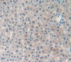 Immunohistochemistry (Formalin/PFA-fixed paraffin-embedded sections) - Anti-Factor B antibody (AB231069)