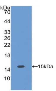 Western blot - Anti-Factor B antibody (AB231069)