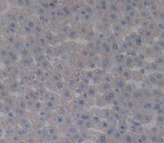 Immunohistochemistry (Formalin/PFA-fixed paraffin-embedded sections) - Anti-Factor B antibody (AB231072), expandable thumbnail