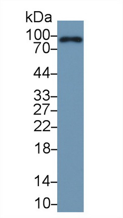Western blot - Anti-Factor B antibody (AB231072), expandable thumbnail