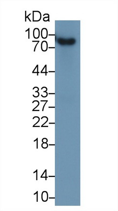 Western blot - Anti-Factor B antibody (AB231072), expandable thumbnail