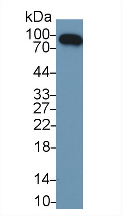 Western blot - Anti-Factor B antibody (AB231072), expandable thumbnail