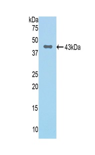 Western blot - Anti-Factor B antibody (AB231072), expandable thumbnail