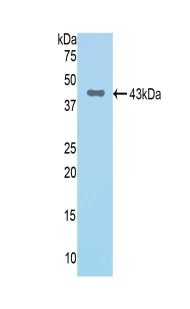 Western blot - Anti-Factor B antibody (AB231072)