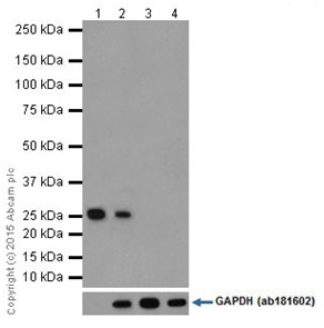 Western blot - Anti-Factor D/CFD antibody [EPR14699] (AB204917)