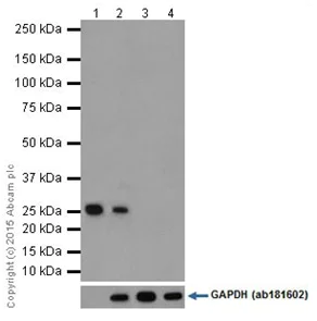 Western blot - Anti-Factor D/CFD antibody [EPR14699] (AB204917)