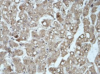 Immunohistochemistry (Formalin/PFA-fixed paraffin-embedded sections) - Anti-Factor H antibody (AB170036)