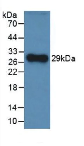 Western blot - Anti-Factor H antibody [C3] (AB239612)