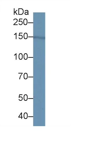 Western blot - Anti-Factor H antibody [C3] (AB239612)