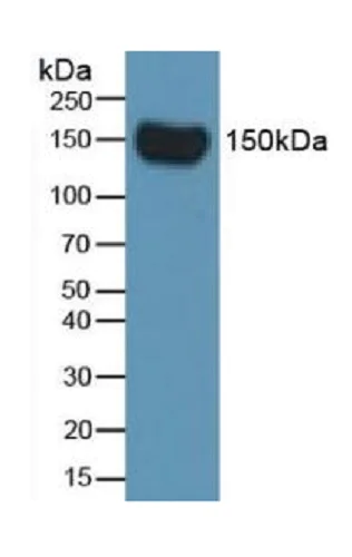 Western blot - Anti-Factor H antibody [C3] (AB239612)