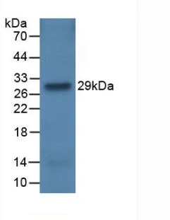 Western blot - Anti-Factor H antibody [C5] (AB239593)