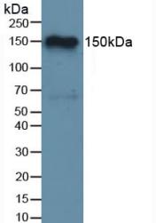 Western blot - Anti-Factor H antibody [C5] (AB239593)