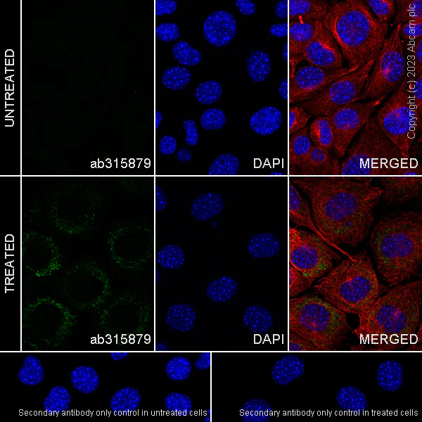 Immunocytochemistry/ Immunofluorescence - Anti-Factor H antibody [EPR26491-30] (AB315879)