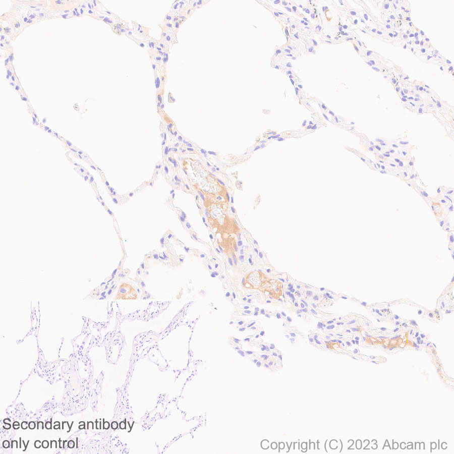 Immunohistochemistry (Formalin/PFA-fixed paraffin-embedded sections) - Anti-Factor H antibody [EPR26491-30] - BSA and Azide free (ab315880), expandable thumbnail