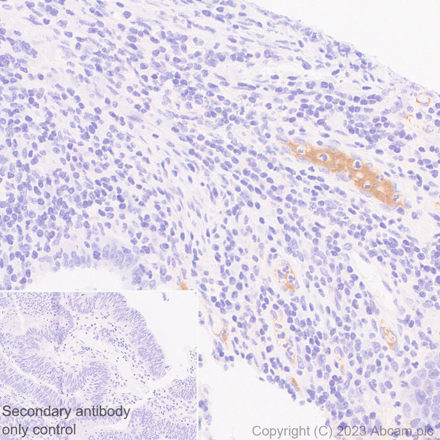 Immunohistochemistry (Formalin/PFA-fixed paraffin-embedded sections) - Anti-Factor H antibody [EPR26491-30] - BSA and Azide free (ab315880), expandable thumbnail
