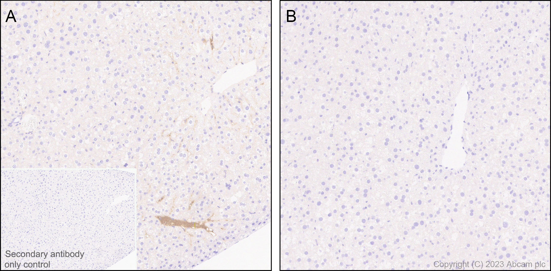 Immunohistochemistry (Formalin/PFA-fixed paraffin-embedded sections) - Anti-Factor H antibody [EPR26491-30] - BSA and Azide free (ab315880), expandable thumbnail