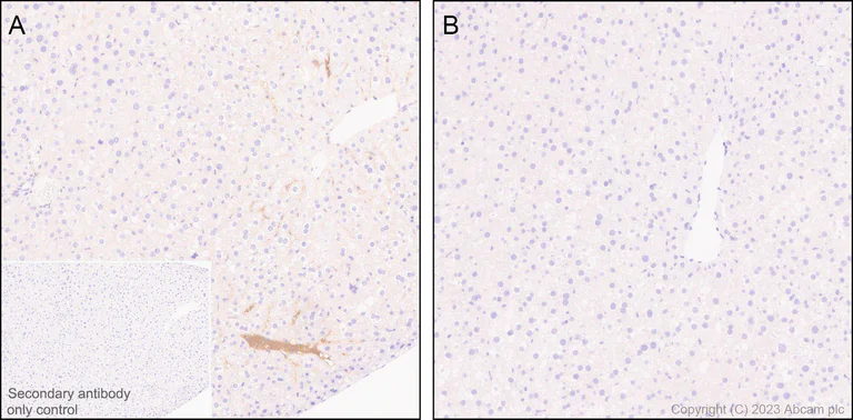 Immunohistochemistry (Formalin/PFA-fixed paraffin-embedded sections) - Anti-Factor H antibody [EPR26491-30] - BSA and Azide free (AB315880)