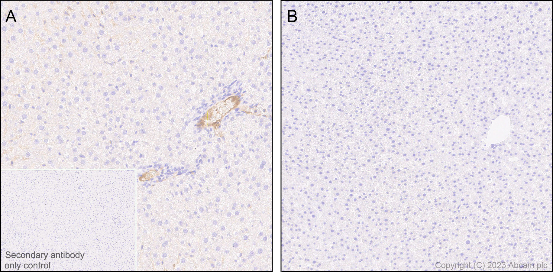 Immunohistochemistry (Formalin/PFA-fixed paraffin-embedded sections) - Anti-Factor H antibody [EPR26491-30] - BSA and Azide free (ab315880), expandable thumbnail