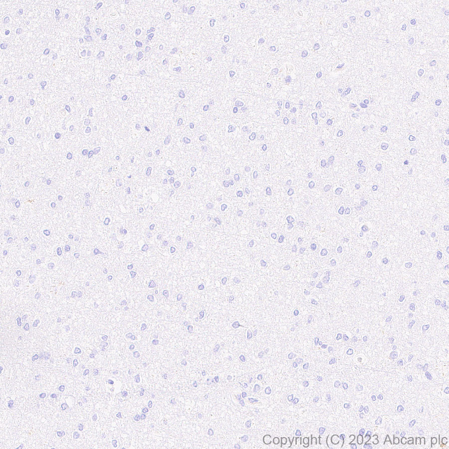 Immunohistochemistry (Formalin/PFA-fixed paraffin-embedded sections) - Anti-Factor H antibody [EPR26491-30] - BSA and Azide free (ab315880), expandable thumbnail