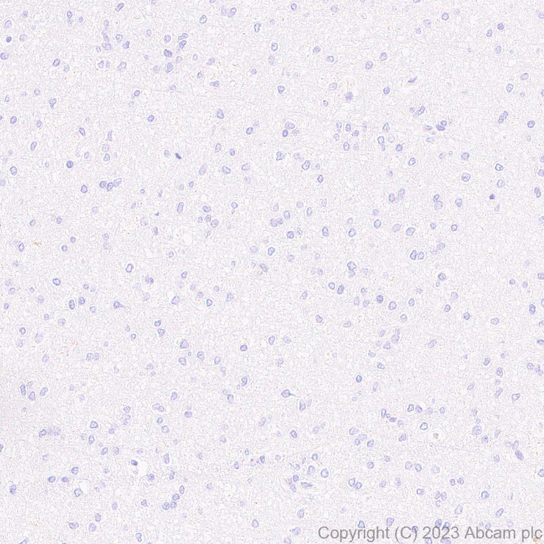 Immunohistochemistry (Formalin/PFA-fixed paraffin-embedded sections) - Anti-Factor H antibody [EPR26491-30] - BSA and Azide free (AB315880)