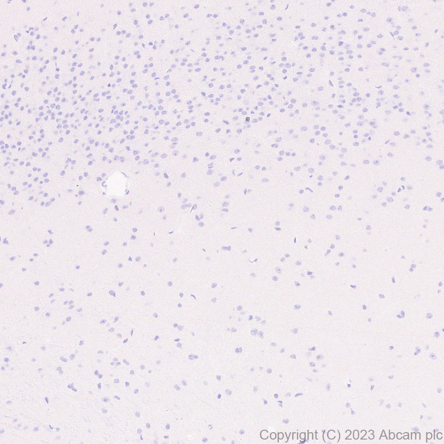 Immunohistochemistry (Formalin/PFA-fixed paraffin-embedded sections) - Anti-Factor H antibody [EPR26491-30] - BSA and Azide free (ab315880), expandable thumbnail