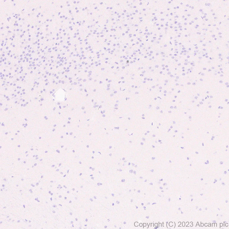 Immunohistochemistry (Formalin/PFA-fixed paraffin-embedded sections) - Anti-Factor H antibody [EPR26491-30] - BSA and Azide free (AB315880)