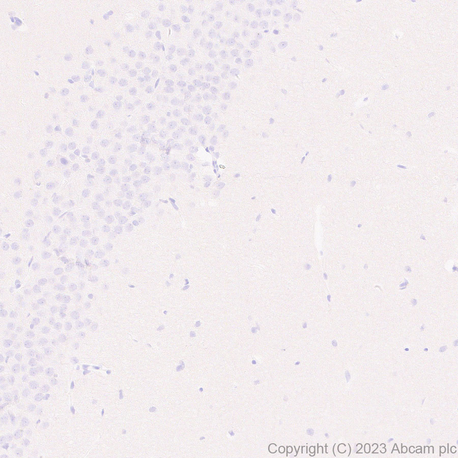 Immunohistochemistry (Formalin/PFA-fixed paraffin-embedded sections) - Anti-Factor H antibody [EPR26491-30] - BSA and Azide free (ab315880), expandable thumbnail