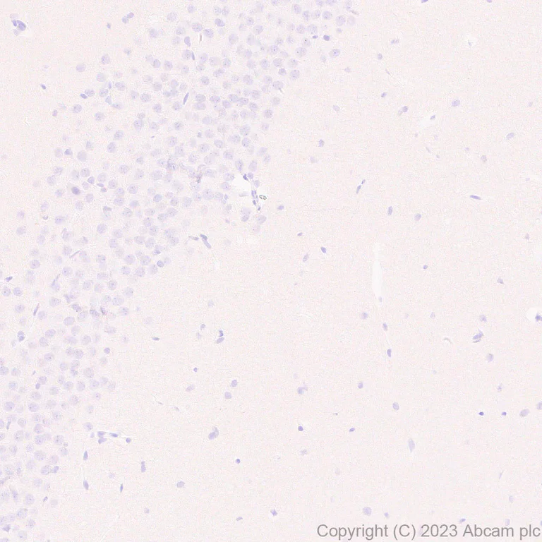 Immunohistochemistry (Formalin/PFA-fixed paraffin-embedded sections) - Anti-Factor H antibody [EPR26491-30] - BSA and Azide free (AB315880)