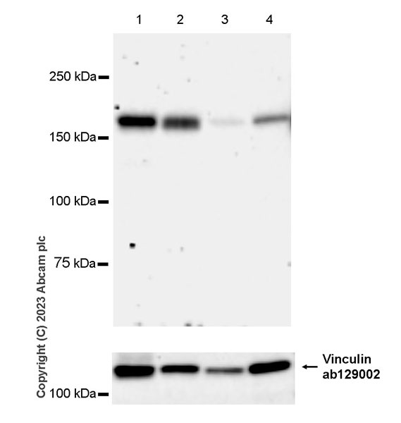 Western blot - Anti-Factor H antibody [EPR26491-30] - BSA and Azide free (AB315880), expandable thumbnail