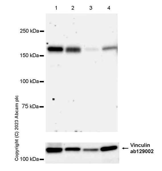 Western blot - Anti-Factor H antibody [EPR26491-30] - BSA and Azide free (AB315880)