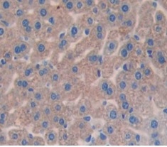 Immunohistochemistry (Formalin/PFA-fixed paraffin-embedded sections) - Anti-Factor I/CFI antibody (AB231969)