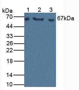 Western blot - Anti-Factor I/CFI antibody (AB231969)