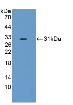 Western blot - Anti-Factor I/CFI antibody (AB231969)
