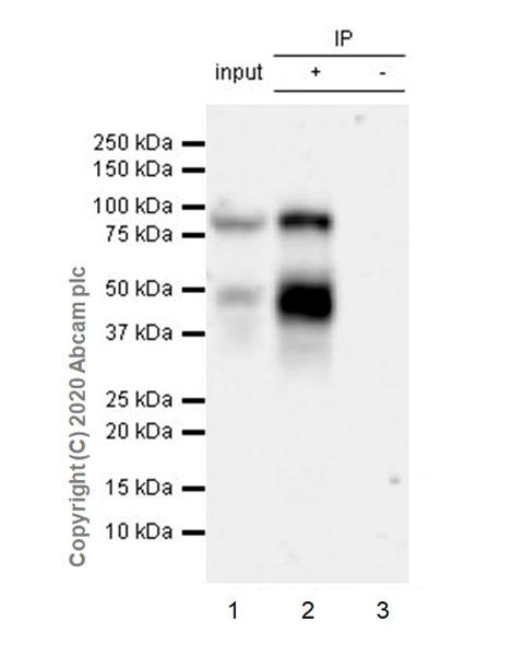 Immunoprecipitation - Anti-Factor I/CFI antibody [EPR23948-48] (AB278524), expandable thumbnail