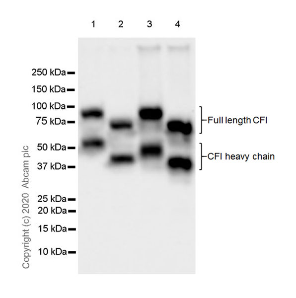 Western blot - Anti-Factor I/CFI antibody [EPR23948-48] (AB278524), expandable thumbnail