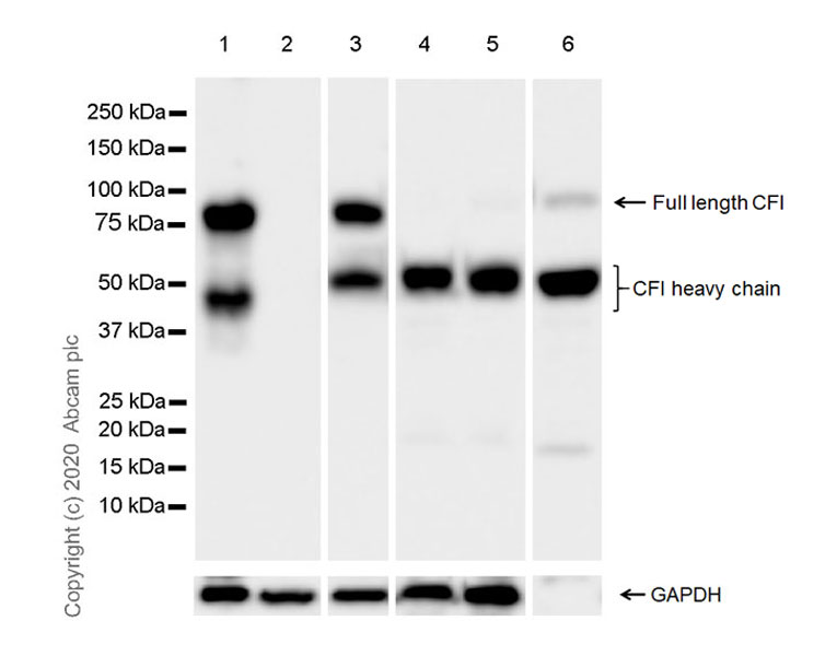 Western blot - Anti-Factor I/CFI antibody [EPR23948-48] (AB278524), expandable thumbnail